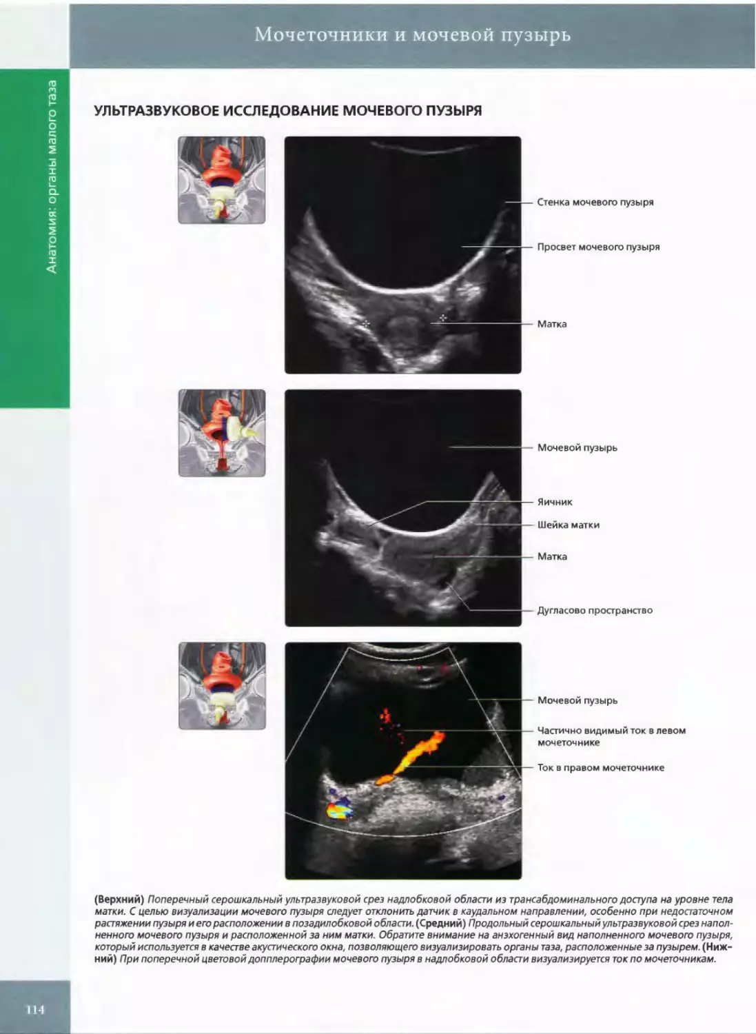 УЛЬТРАЗВУКОВОЕ ИССЛЕДОВАНИЕ МОЧЕВОГО ПУЗЫРЯ