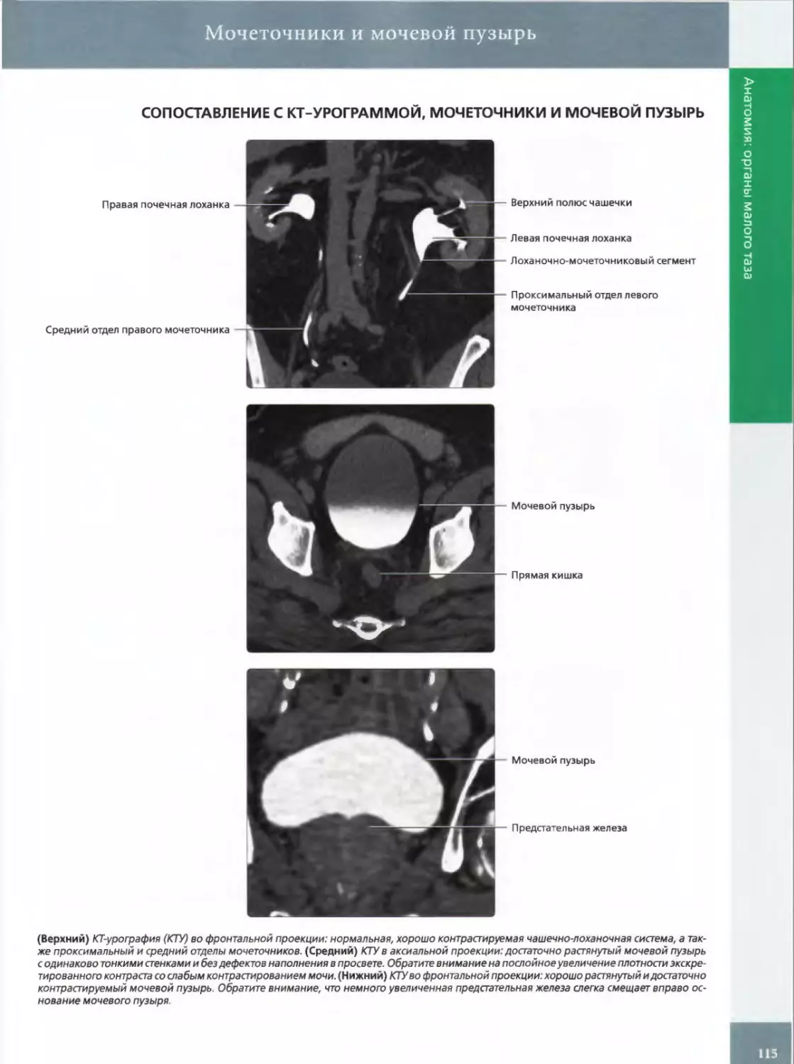 СОПОСТАВЛЕНИЕ С КТ-УРОГРАММОЙ, МОЧЕТОЧНИКИ И МОЧЕВОЙ ПУЗЫРЬ