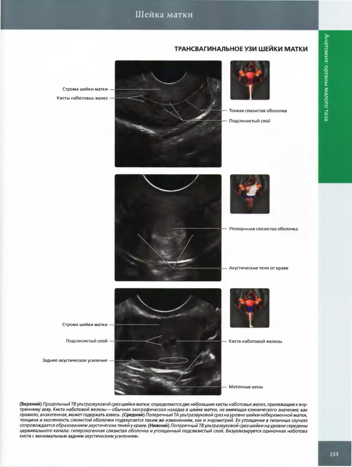 ТРАНСВАГИНАЛЬНОЕ УЗИ ШЕЙКИ МАТКИ