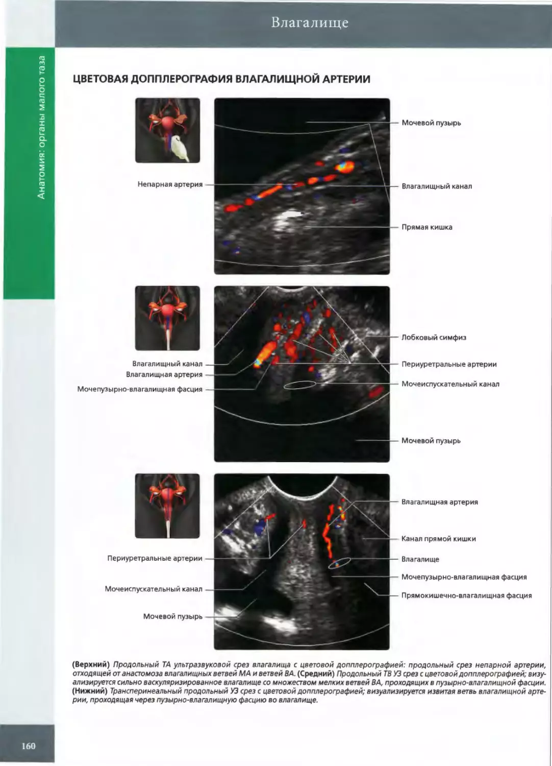 ЦВЕТОВАЯ ДОППЛЕРОГРАФИЯ ВЛАГАЛИЩНОЙ АРТЕРИИ