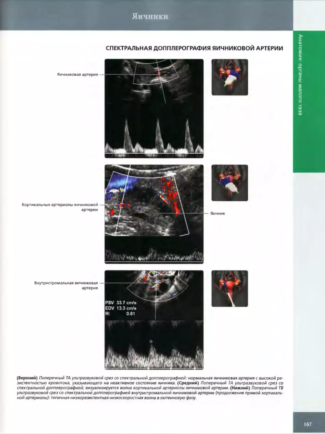 СПЕКТРАЛЬНАЯ ДОППЛЕРОГРАФИЯ ЯИЧНИКОВОЙ АРТЕРИИ