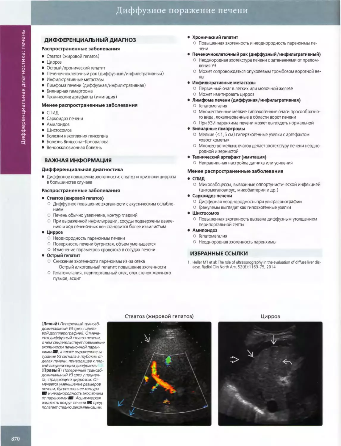 ДИФФЕРЕНЦИАЛЬНЫЙ ДИАГНОЗ
ВАЖНАЯ ИНФОРМАЦИЯ
•	Стеатоз (жировой гепатоз)
•	Цирроз
•	Острый гепатит
•	Хронический гепатит
•	Печеночноклеточный рак (диффузный/инфильтративный)
•	Инфильтративные метастазы
•	Лимфома печени (диффузная/инфильтративная)
•	Билиарные гамартромы
•	Технический артефакт (имитация)
•	СПИД
•	Саркоидоз печени
•	Шистосомоз
•	Амилоидоз