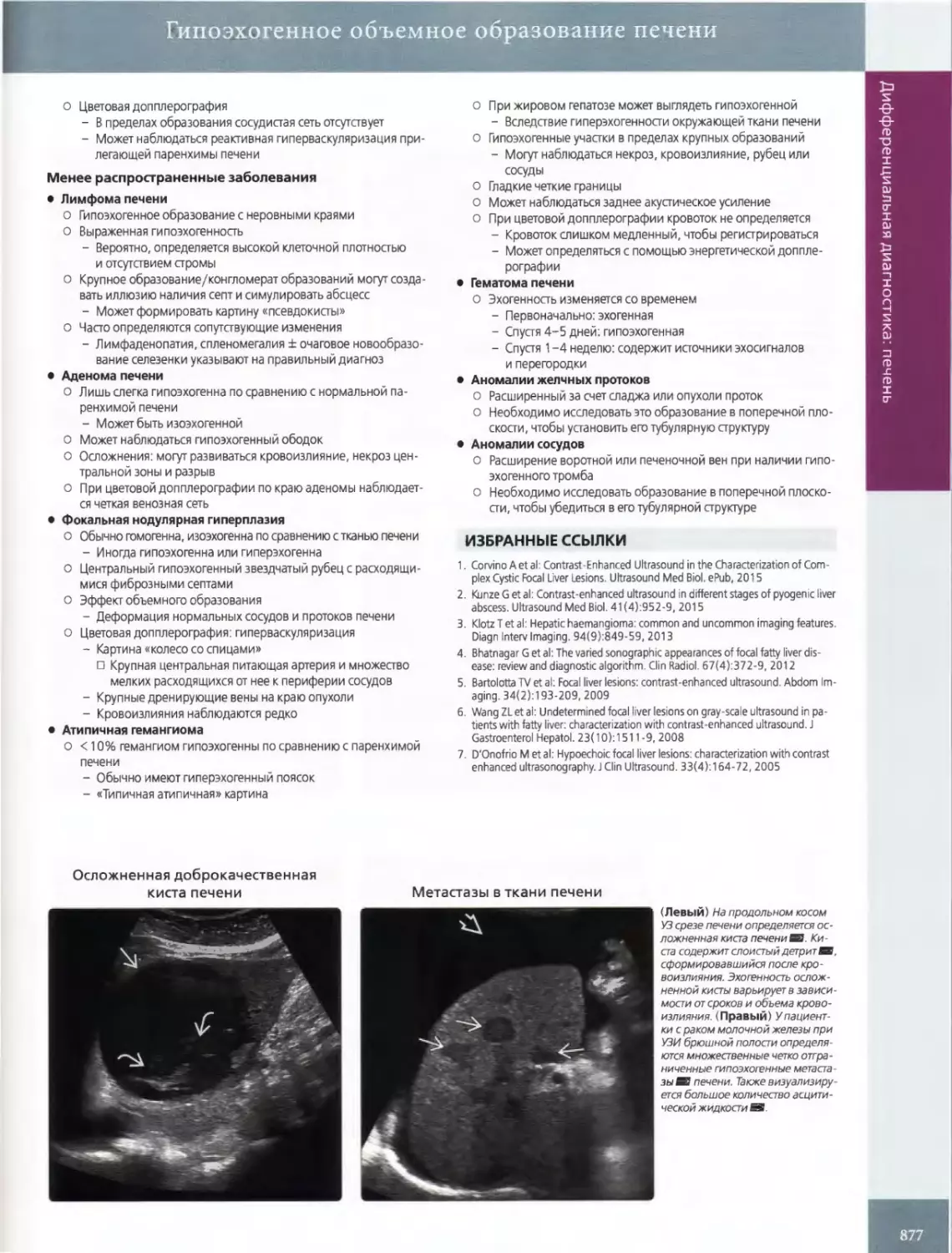 •	Лимфома печени
•	Аденома печени
•	Фокальная нодулярная гиперплазия
•	Атипичная гемангиома
•	Гематома печени
•	Аномалии желчных протоков
•	Аномалии сосудов
ИЗБРАННЫЕ ССЫЛКИ
