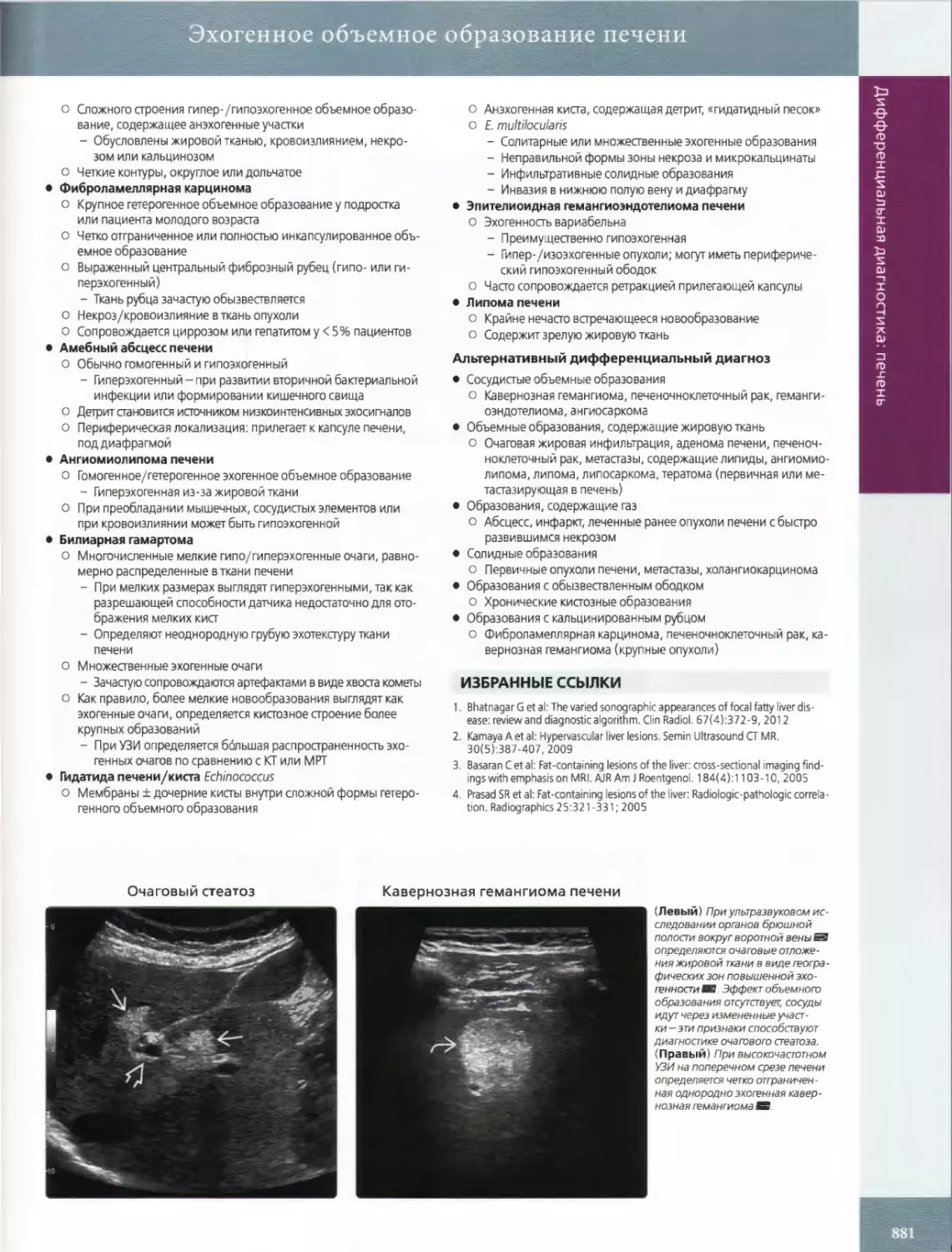 •	Фиброламеллярная карцинома
•	Амебный абсцесс печени
•	Ангиомиолипома печени
•	Билиарная гамартома
•	Липома печени
ИЗБРАННЫЕ ССЫЛКИ