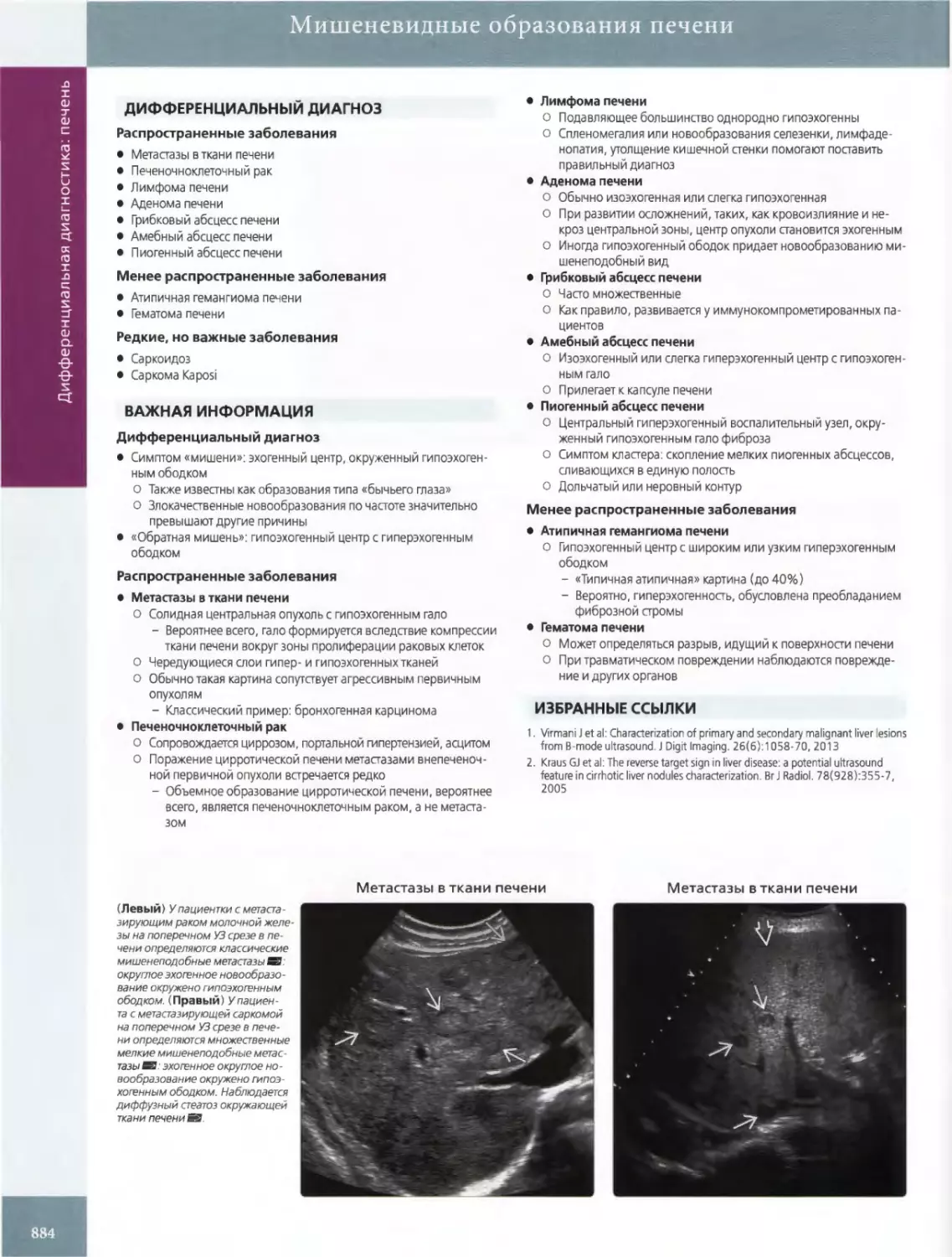 ДИФФЕРЕНЦИАЛЬНЫЙ ДИАГНОЗ
ВАЖНАЯ ИНФОРМАЦИЯ
•	Метастазы в ткани печени
•	Печеночноклеточный рак
•	Лимфома печени
•	Аденома печени
•	Амебный абсцесс печени
•	Пиогенный абсцесс печени
•	Атипичная гемангиома печени
•	Гематома печени
ИЗБРАННЫЕ ССЫЛКИ