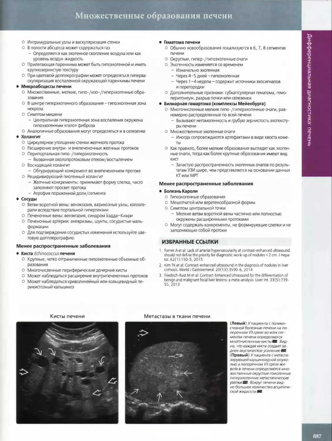 Множественные
•	Микроабсцессы печени
•	Холангит
•	Сосуды
•	Гематома печени
•	Билиарная гамартома (комплексы Мейенбурга)
•	Болезнь Кароли
ИЗБРАННЫЕ ССЫЛКИ