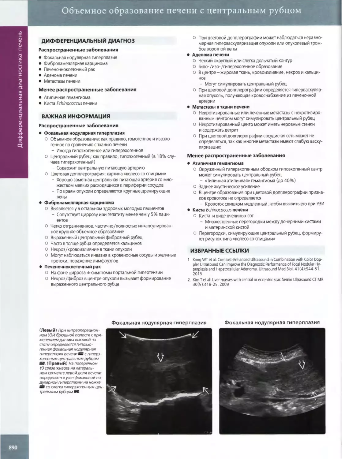 ДИФФЕРЕНЦИАЛЬНЫЙ ДИАГНОЗ
ВАЖНАЯ ИНФОРМАЦИЯ
•	Фокальная нодулярная гиперплазия
•	Фиброламеллярная карцинома
•	Печеночноклеточный рак
•	Аденома печени
•	Метастазы в ткани печени
•	Атипичная гемангиома
ИЗБРАННЫЕ ССЫЛКИ