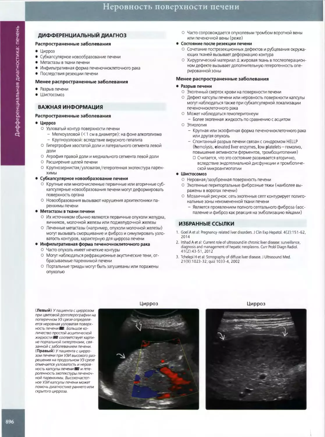 Неровность поверхности печени
ДИФФЕРЕНЦИАЛЬНЫЙ ДИАГНОЗ
ВАЖНАЯ ИНФОРМАЦИЯ
•	Цирроз
•	Субкапсулярное новообразование печени
•	Метастазы в ткани печени
•	Состояние после резекции печени
•	Разрыв печени
•	Шистосомоз
ИЗБРАННЫЕ ССЫЛКИ