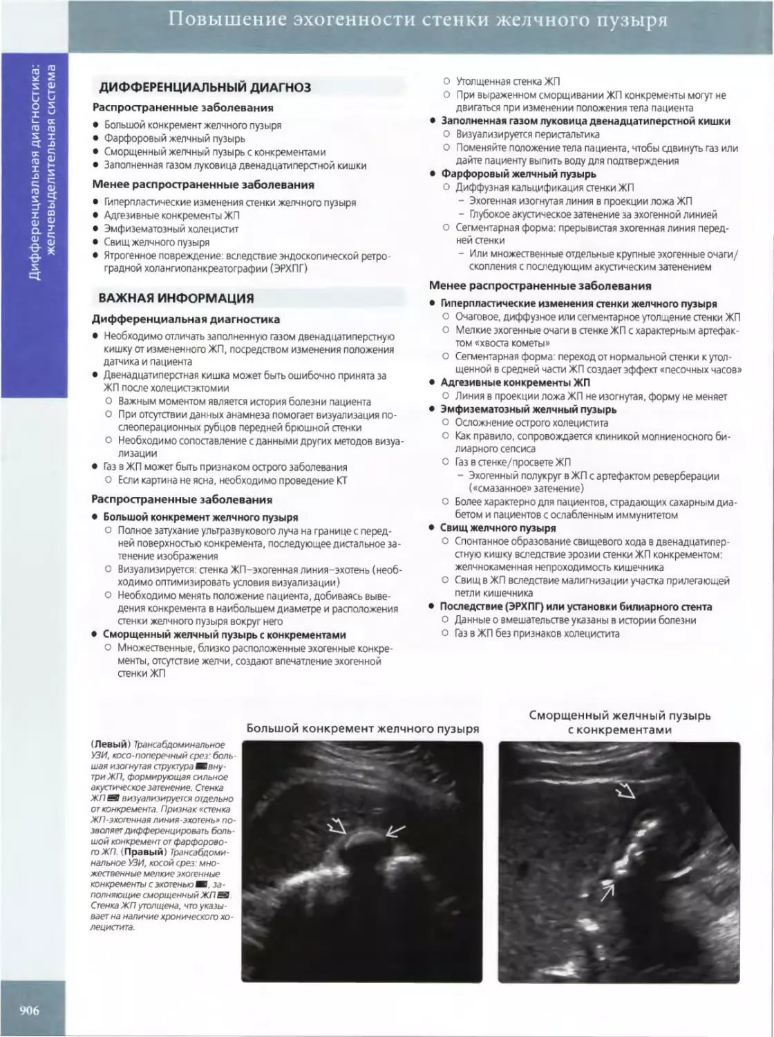 ДИФФЕРЕНЦИАЛЬНЫЙ ДИАГНОЗ
ВАЖНАЯ ИНФОРМАЦИЯ
•	Большой конкремент желчного пузыря
•	Сморщенный желчный пузырь с конкрементами
•	Заполненная газом луковица двенадцатиперстной кишки
•	Фарфоровый желчный пузырь
•	Гиперпластические изменения стенки желчного пузыря
•	Адгезивные конкременты ЖП
•	Свищ желчного пузыря