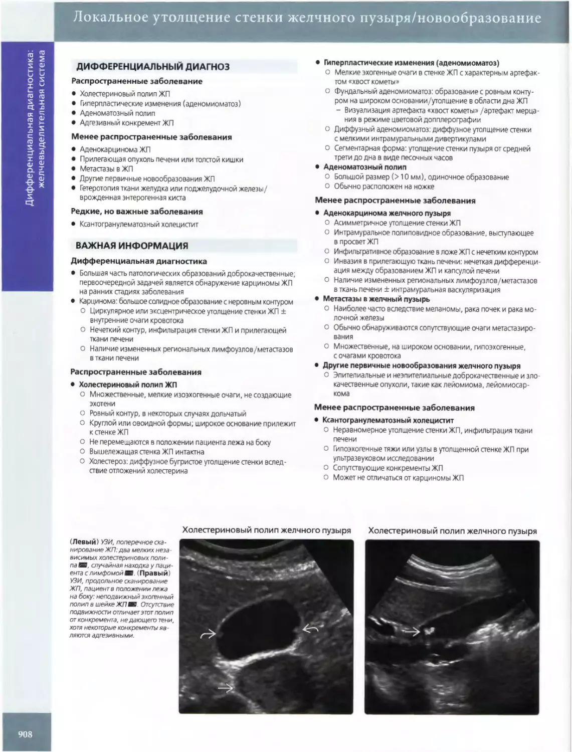 Локальное утолщение стенки желчного пузыря/новообразование
ДИФФЕРЕНЦИАЛЬНЫЙ ДИАГНОЗ
ВАЖНАЯ ИНФОРМАЦИЯ