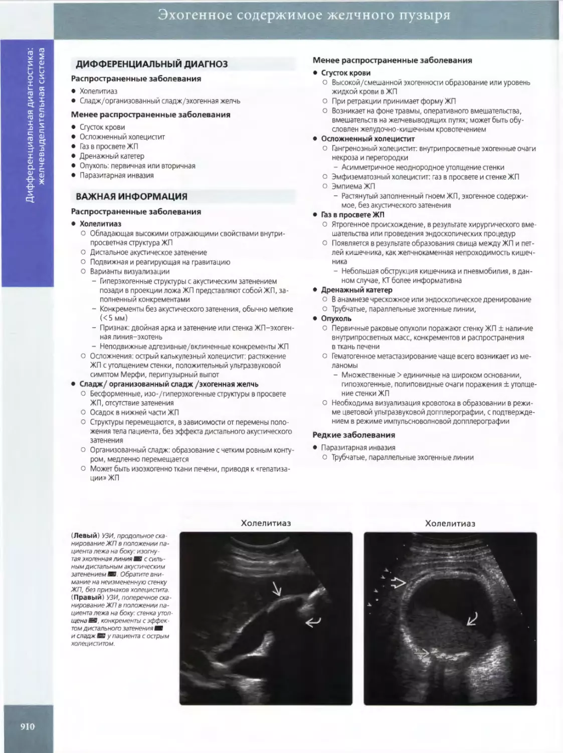 ДИФФЕРЕНЦИАЛЬНЫЙ ДИАГНОЗ
ВАЖНАЯ ИНФОРМАЦИЯ
•	Холелитиаз
•	Сладж/ организованный сладж /эхогенная желчь
•	Сгусток крови
•	Осложненный холецистит
•	Газ в просвете ЖП
•	Дренажный катетер
•	Опухоль