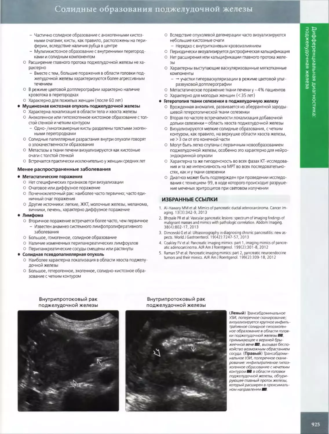 •	Муцинозная кистозная опухоль поджелудочной железы
•	Метастатические поражения
•	Лимфома
•	Солидная псевдопапиллярная опухоль
ИЗБРАННЫЕ ССЫЛКИ