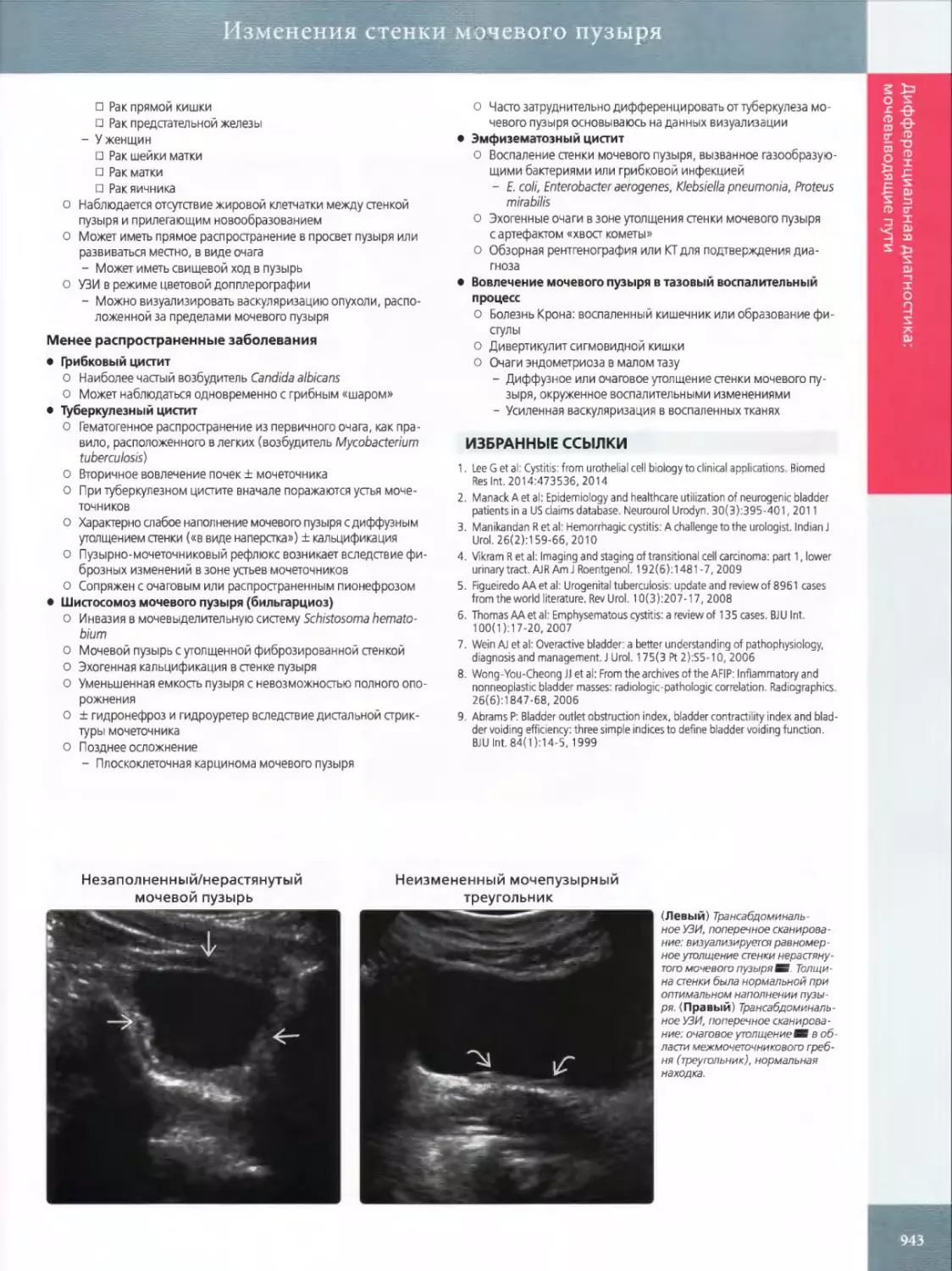•	Грибковый цистит
•	Туберкулезный цистит
•	Шистосомоз мочевого пузыря (бильгарциоз)
•	Эмфизематозный цистит
•	Вовлечение мочевого пузыря в тазовый воспалительный процесс
ИЗБРАННЫЕ ССЫЛКИ