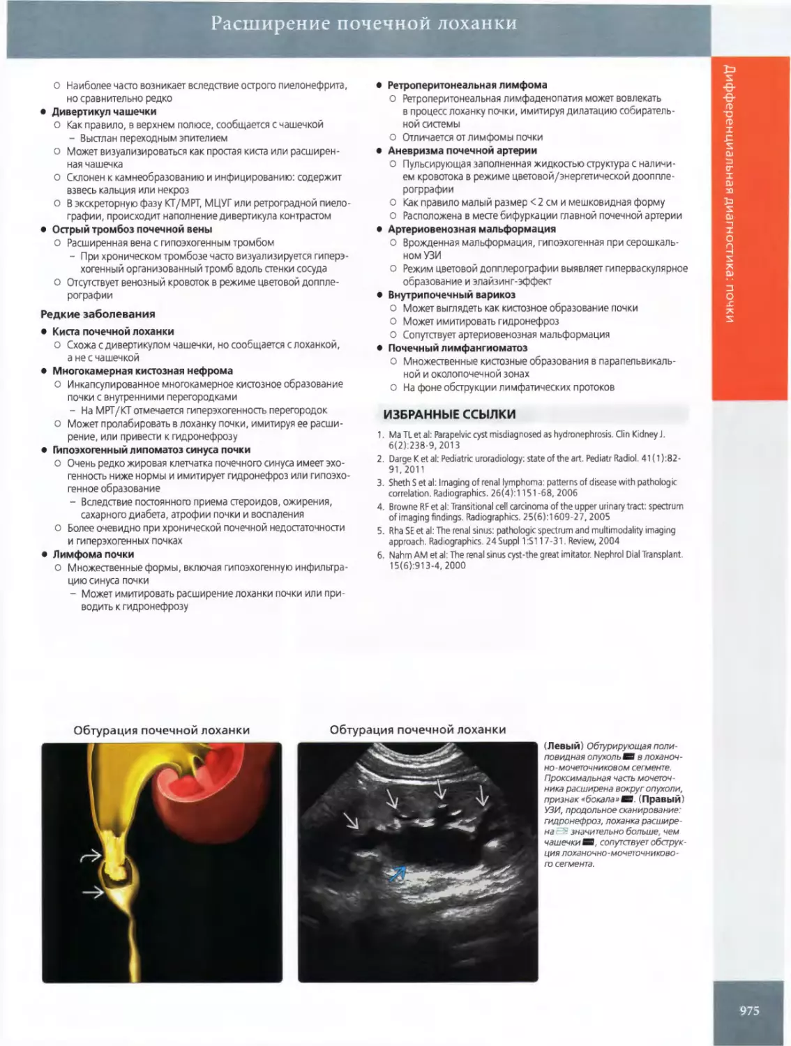 •	Дивертикул чашечки
•	Острый тромбоз почечной вены
•	Киста почечной лоханки
•	Многокамерная кистозная нефрома
•	Гипоэхогенный липоматоз синуса почки
•	Лимфома почки
•	Ретроперитонеальная лимфома
•	Аневризма почечной артерии
•	Артериовенозная мальформация
•	Внутрипочечный варикоз
•	Почечный лимфангиоматоз
ИЗБРАННЫЕ ССЫЛКИ