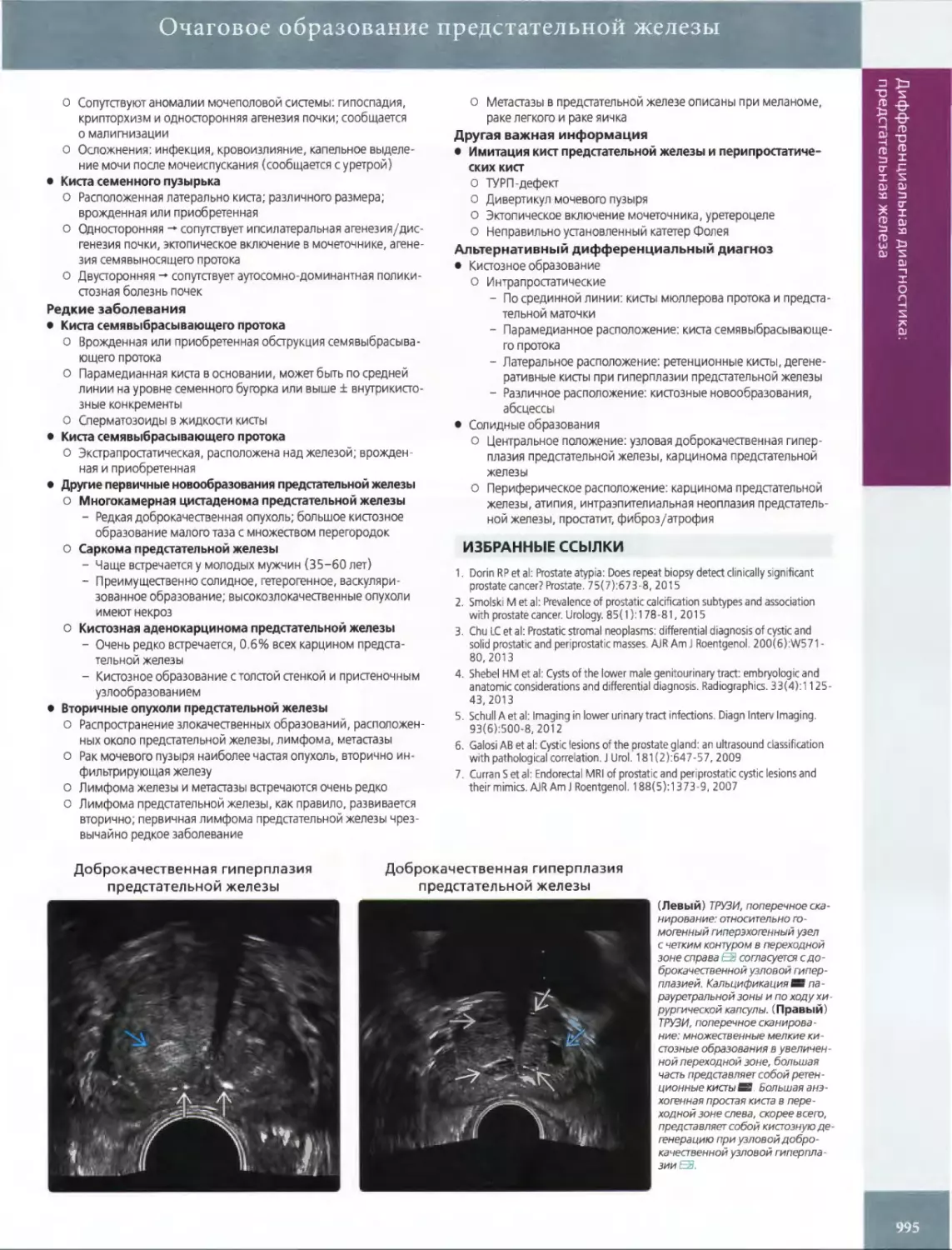 •	Киста семенного пузырька
•	Киста семявыбрасывающего протока
•	Киста семявыбрасывающего протока
•	Другие первичные новообразования предстательной железы о Многокамерная цистаденома предстательной железы
•	Вторичные опухоли предстательной железы
•	Имитация кист предстательной железы и перипростатиче- ских кист
ИЗБРАННЫЕ ССЫЛКИ