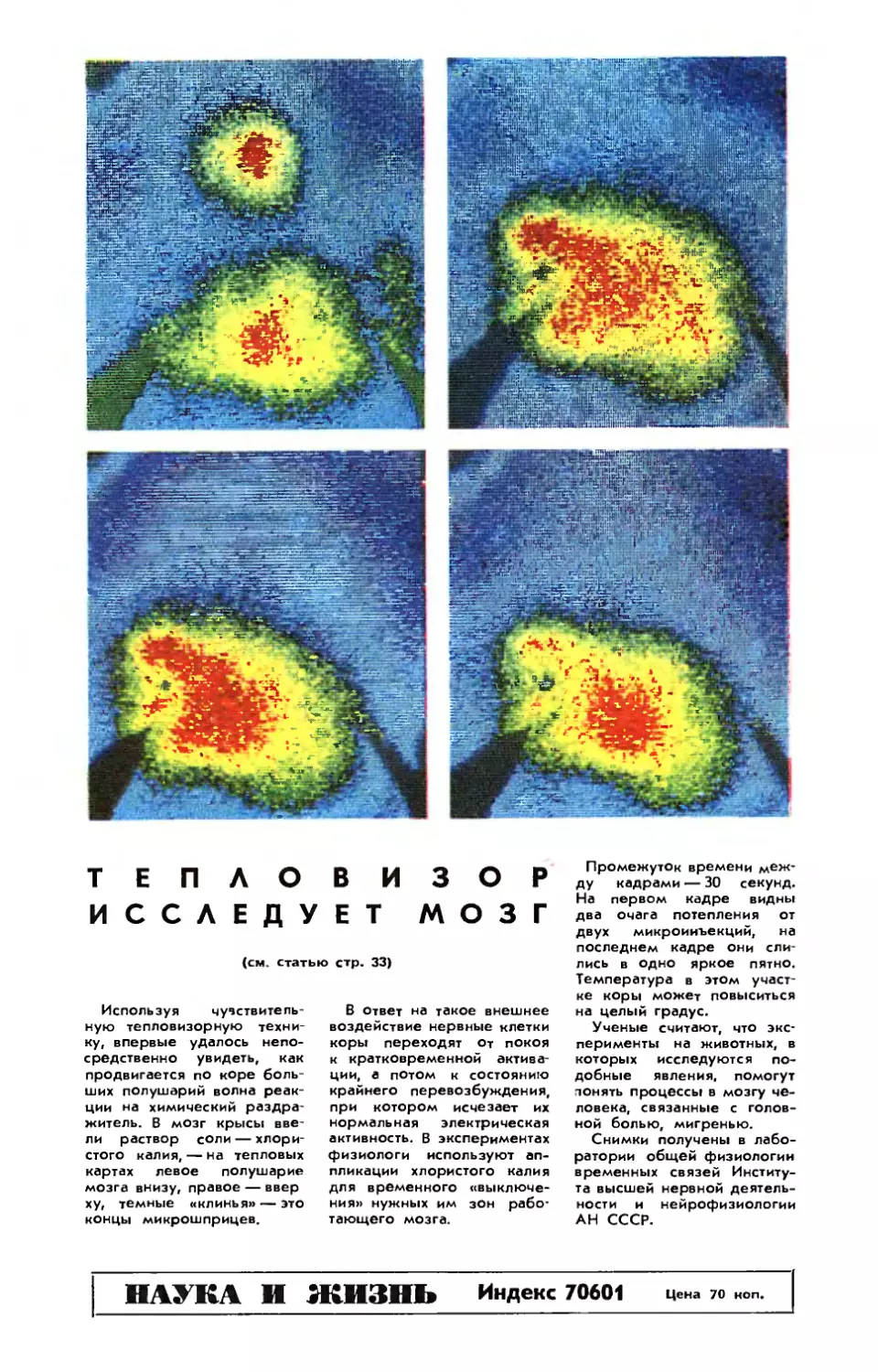 Тепловизор исследует мозг.
[Обложка] — Тепловизор исследует мозг.