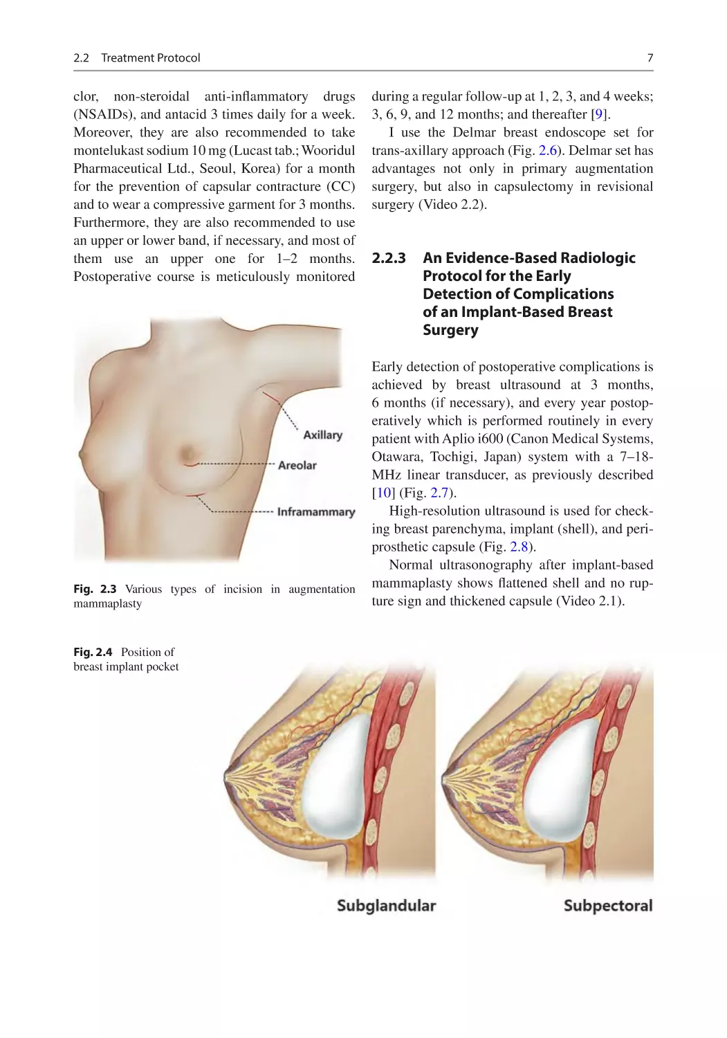 2.2.3	 An Evidence-Based Radiologic Protocol for the Early Detection of Complications of an Implant-Based Breast Surgery