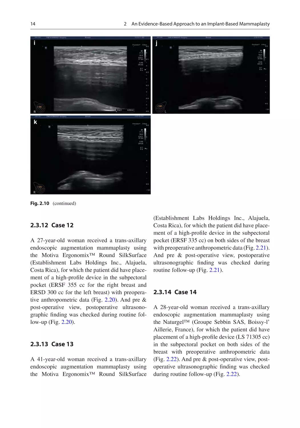 2.3.12	 Case 12
2.3.13	 Case 13
2.3.14	 Case 14