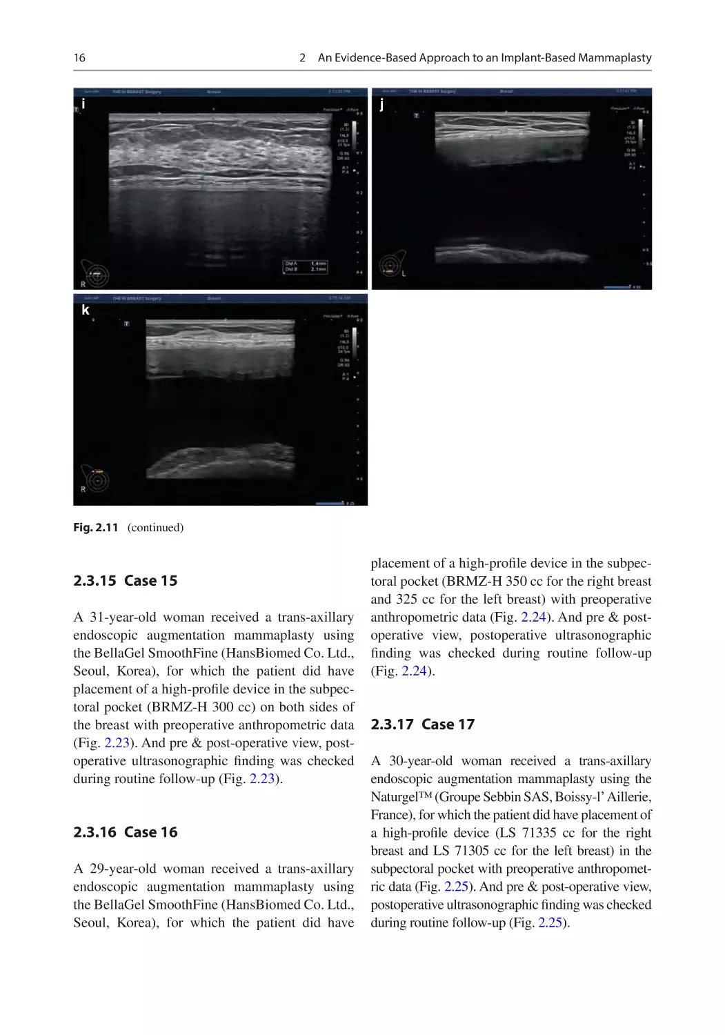 2.3.15	 Case 15
2.3.16	 Case 16
2.3.17	 Case 17