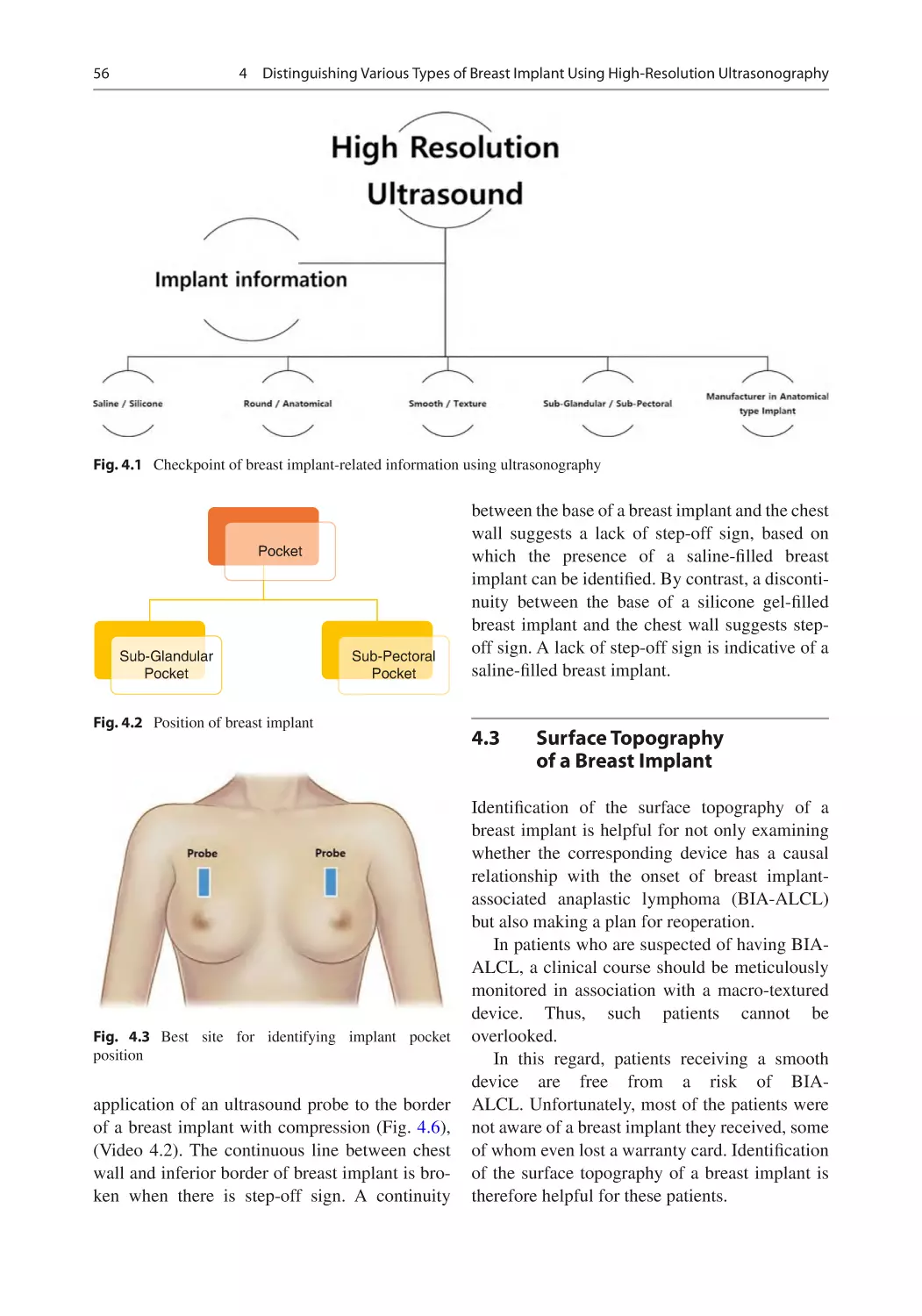 4.3	 Surface Topography of a Breast Implant