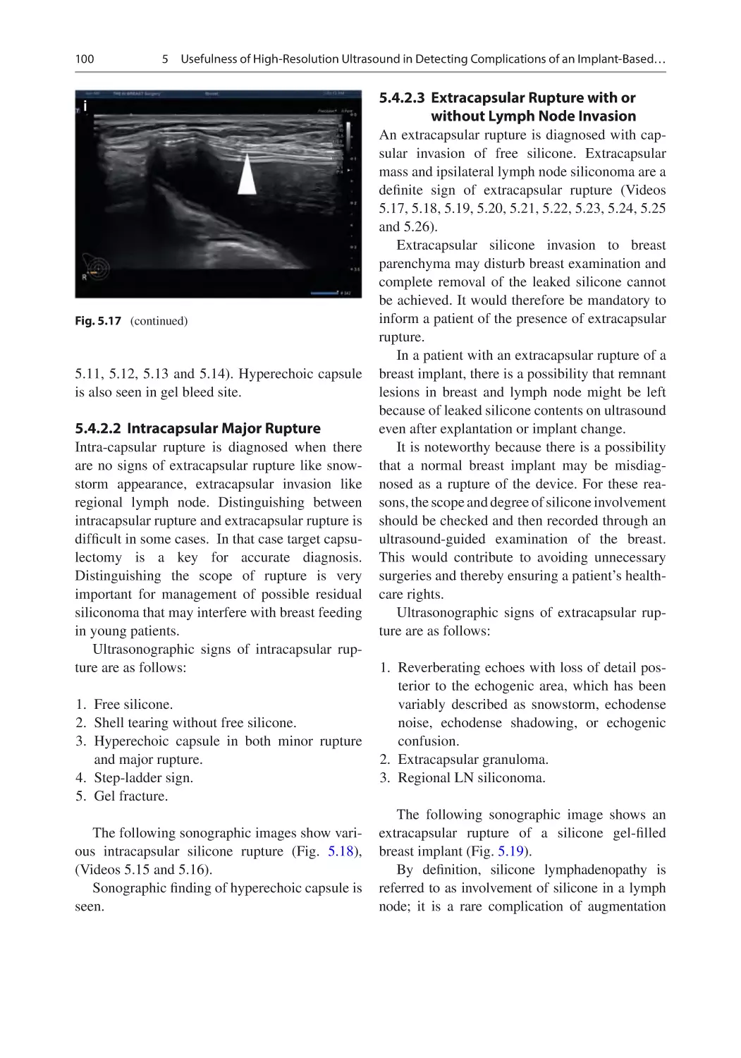 5.4.2.2	 Intracapsular Major Rupture
5.4.2.3	 Extracapsular Rupture with or without Lymph Node Invasion