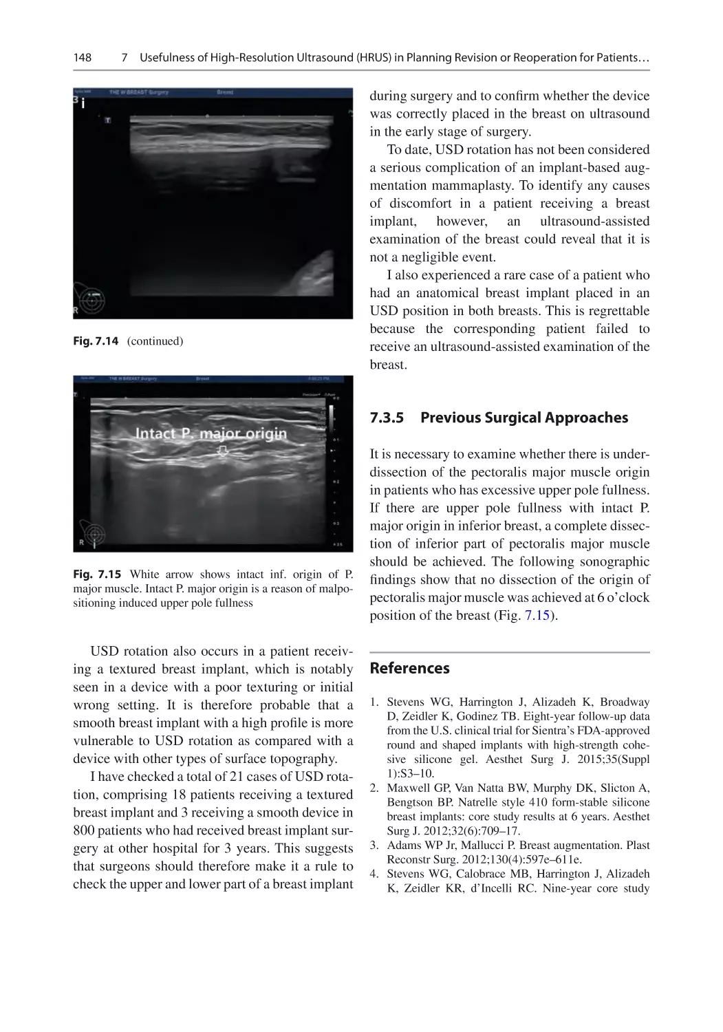 7.3.5	 Previous Surgical Approaches
References