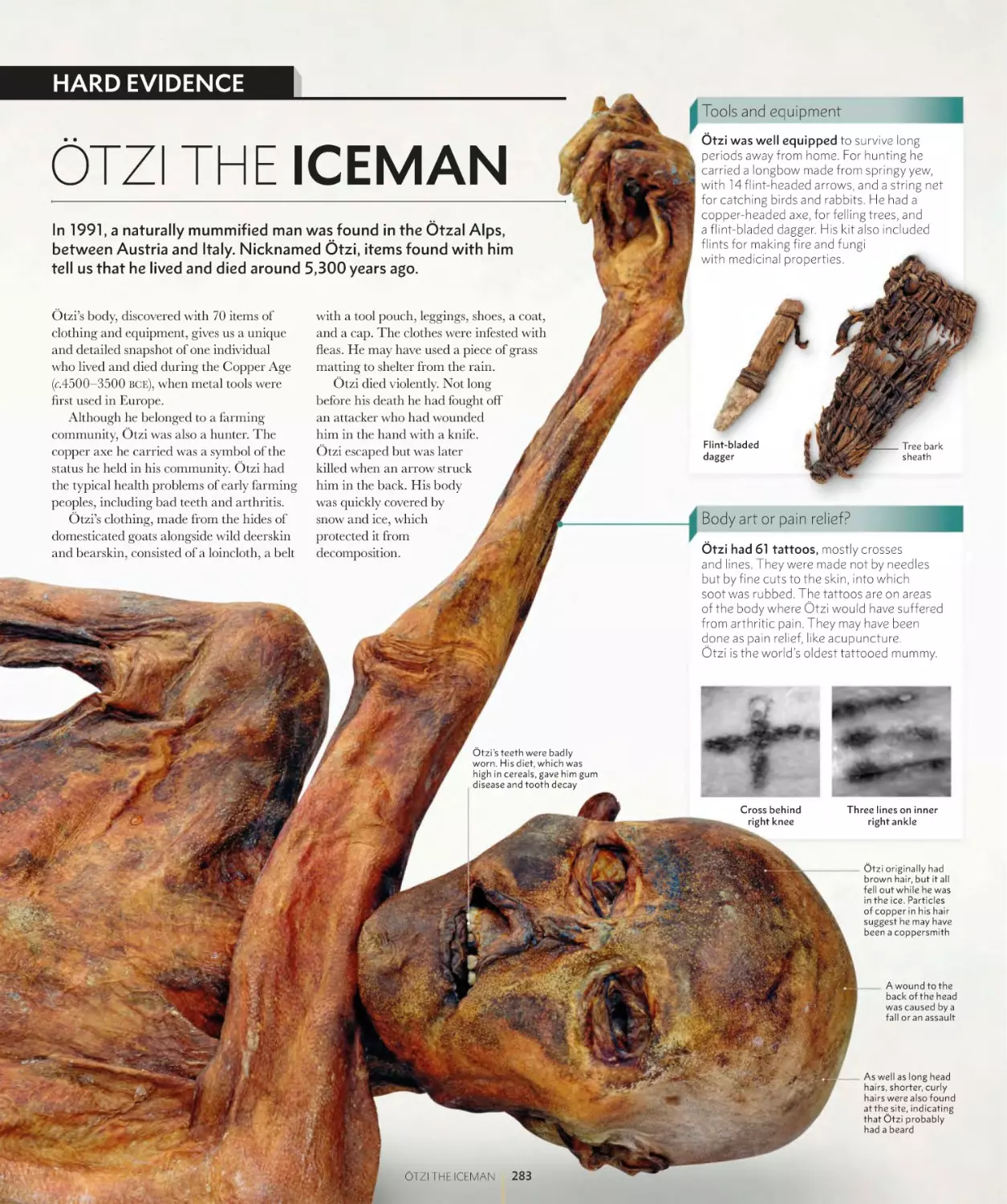 ÖTZI THE ICEMAN