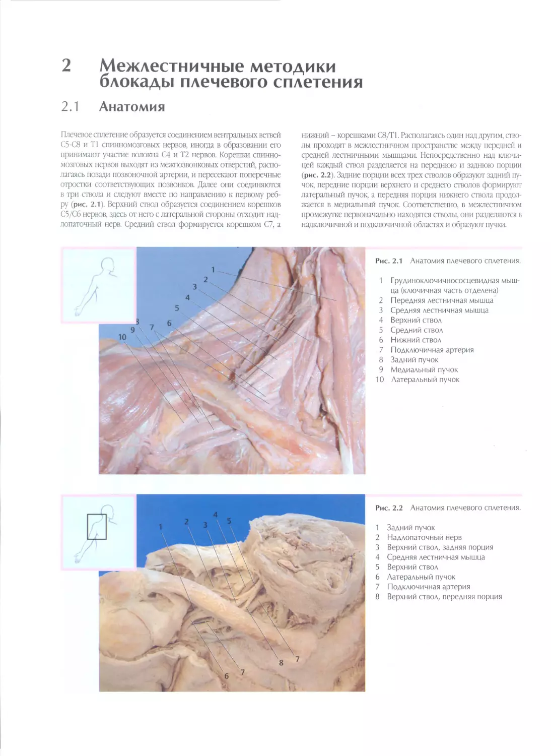 2. Межлестничные методики блокады плечевого сплетения