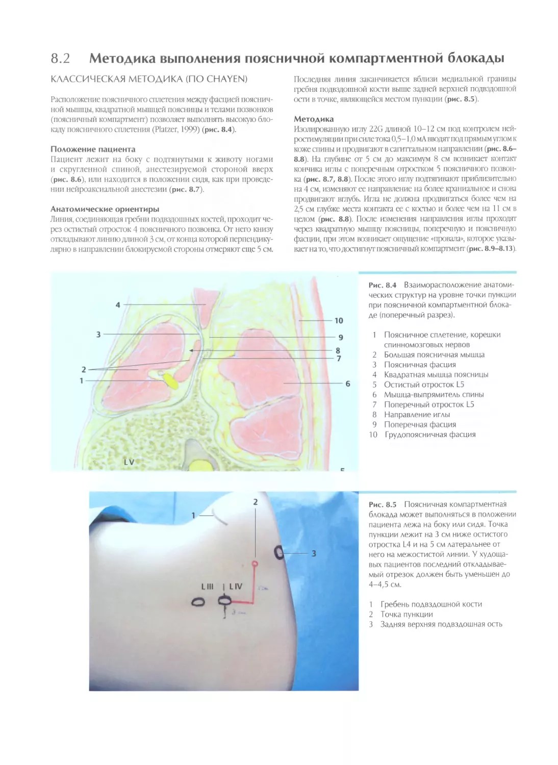8.2. Методика выполнения поясничной компартментной блокады