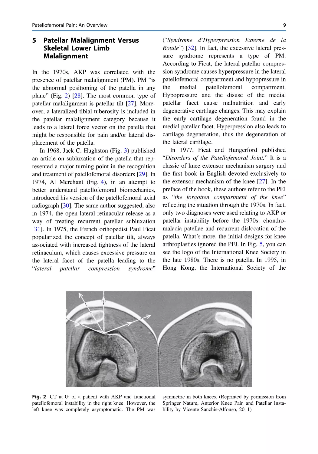 5 Patellar Malalignment Versus Skeletal Lower Limb Malalignment