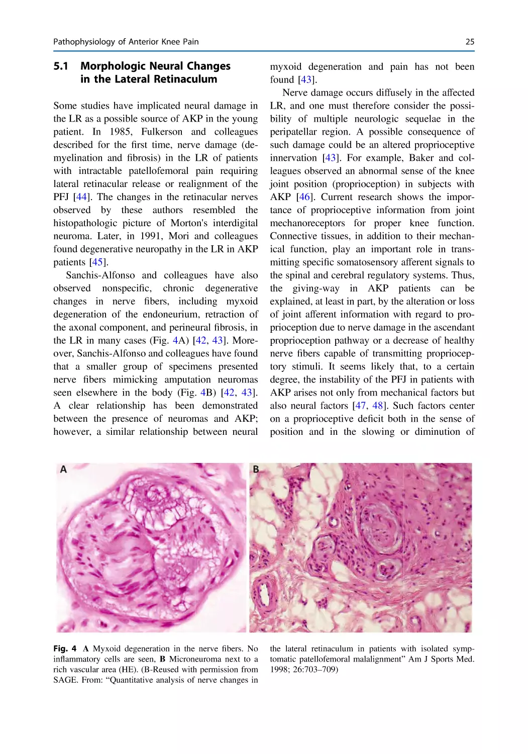 5.1 Morphologic Neural Changes in the Lateral Retinaculum