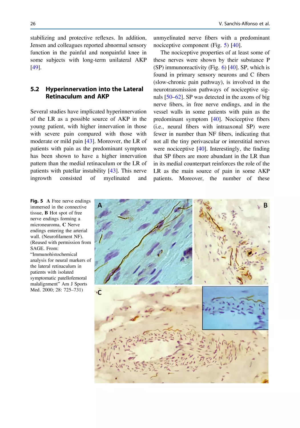 5.2 Hyperinnervation into the Lateral Retinaculum and AKP