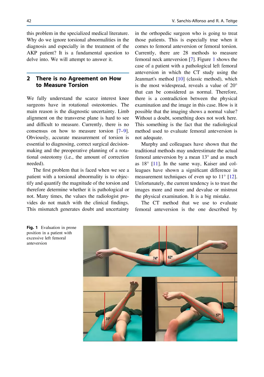 2 There is no Agreement on How to Measure Torsion