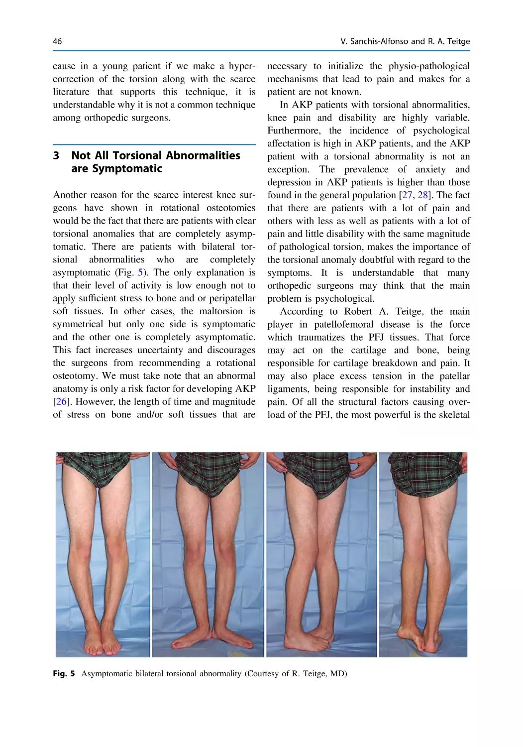 3 Not All Torsional Abnormalities are Symptomatic