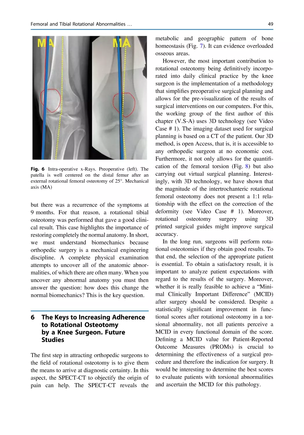 6 The Keys to Increasing Adherence to Rotational Osteotomy by a Knee Surgeon. Future Studies