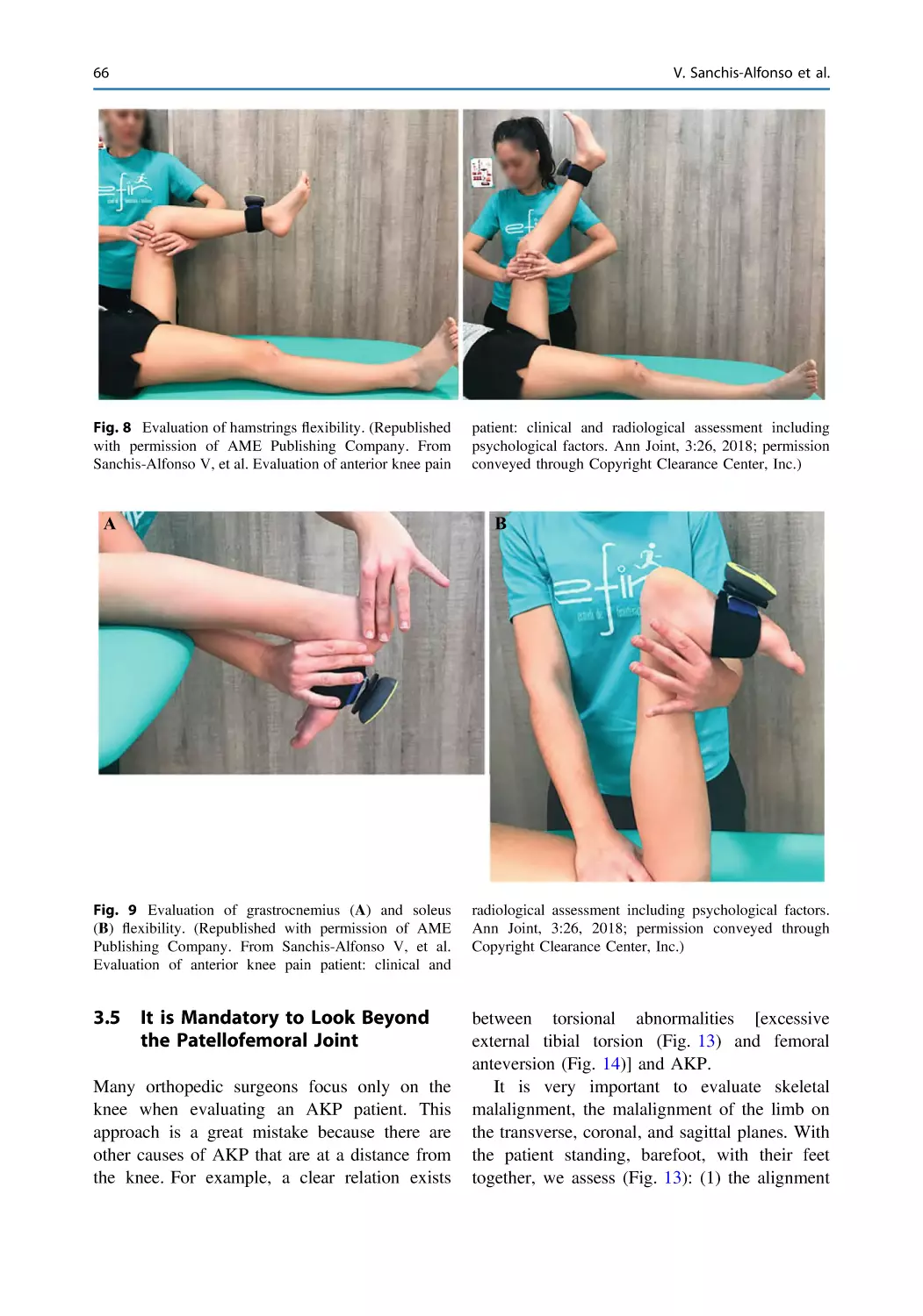 3.5 It is Mandatory to Look Beyond the Patellofemoral Joint