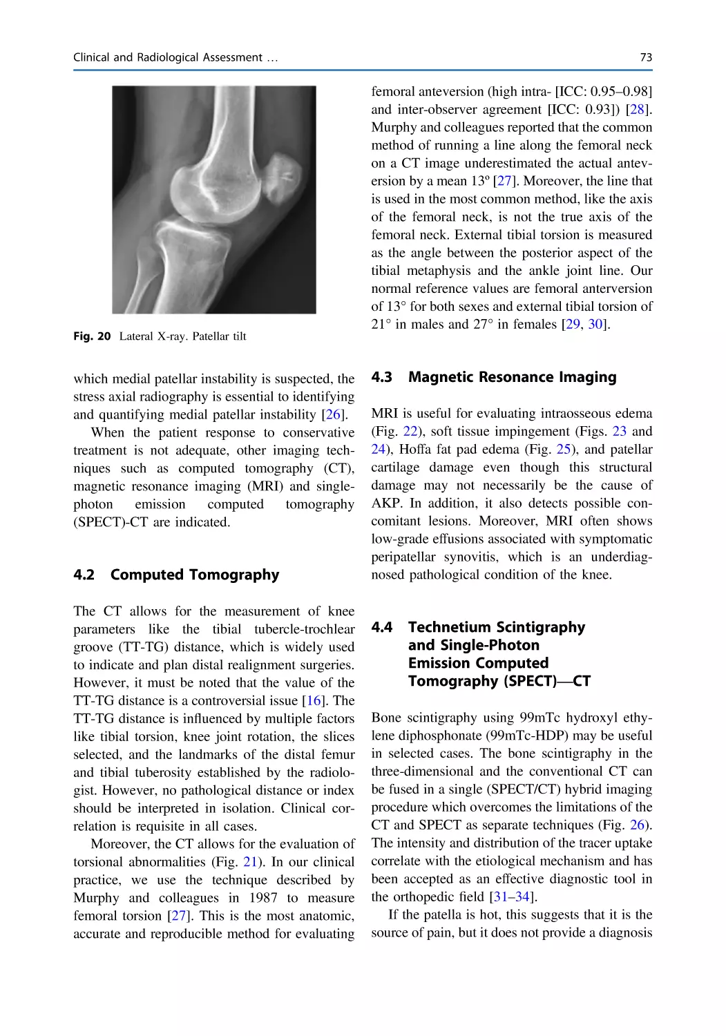 4.2 Computed Tomography
4.3 Magnetic Resonance Imaging
4.4 Technetium Scintigraphy and Single-Photon Emission Computed Tomography (SPECT)—CT