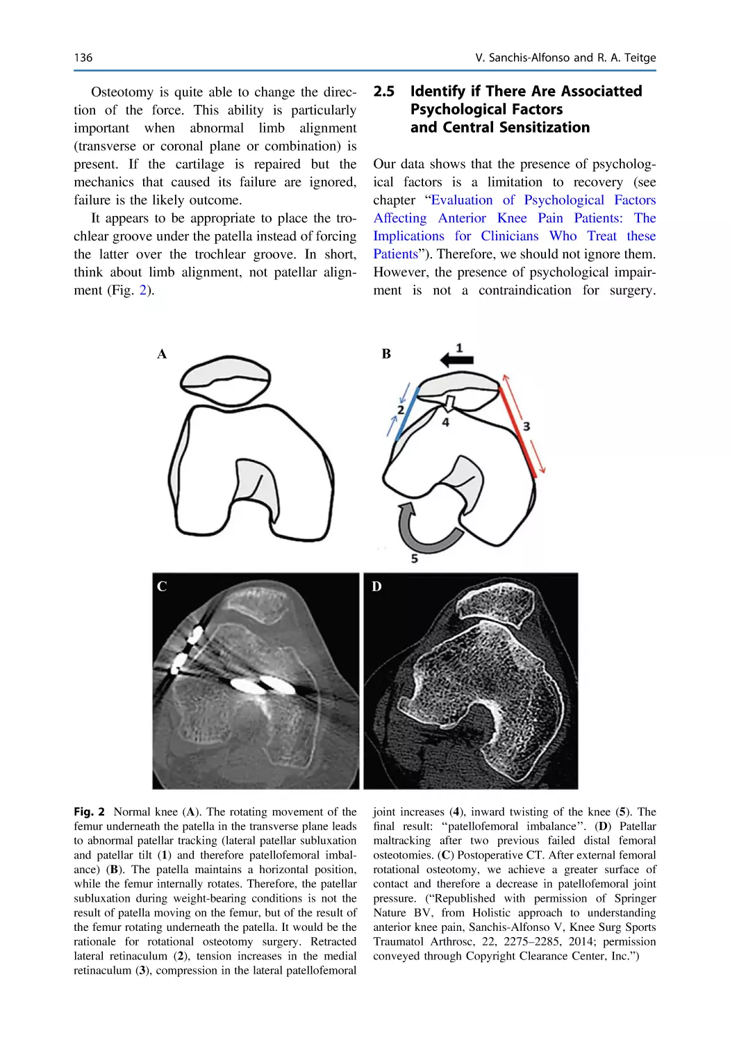 2.5 Identify if There Are Associatted Psychological Factors and Central Sensitization