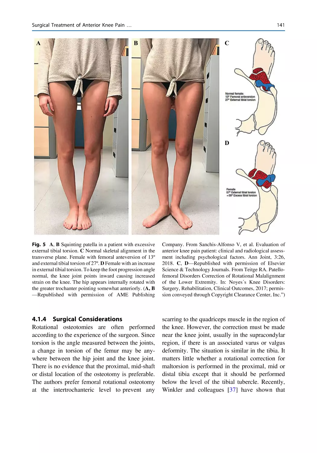 4.1.4 Surgical Considerations