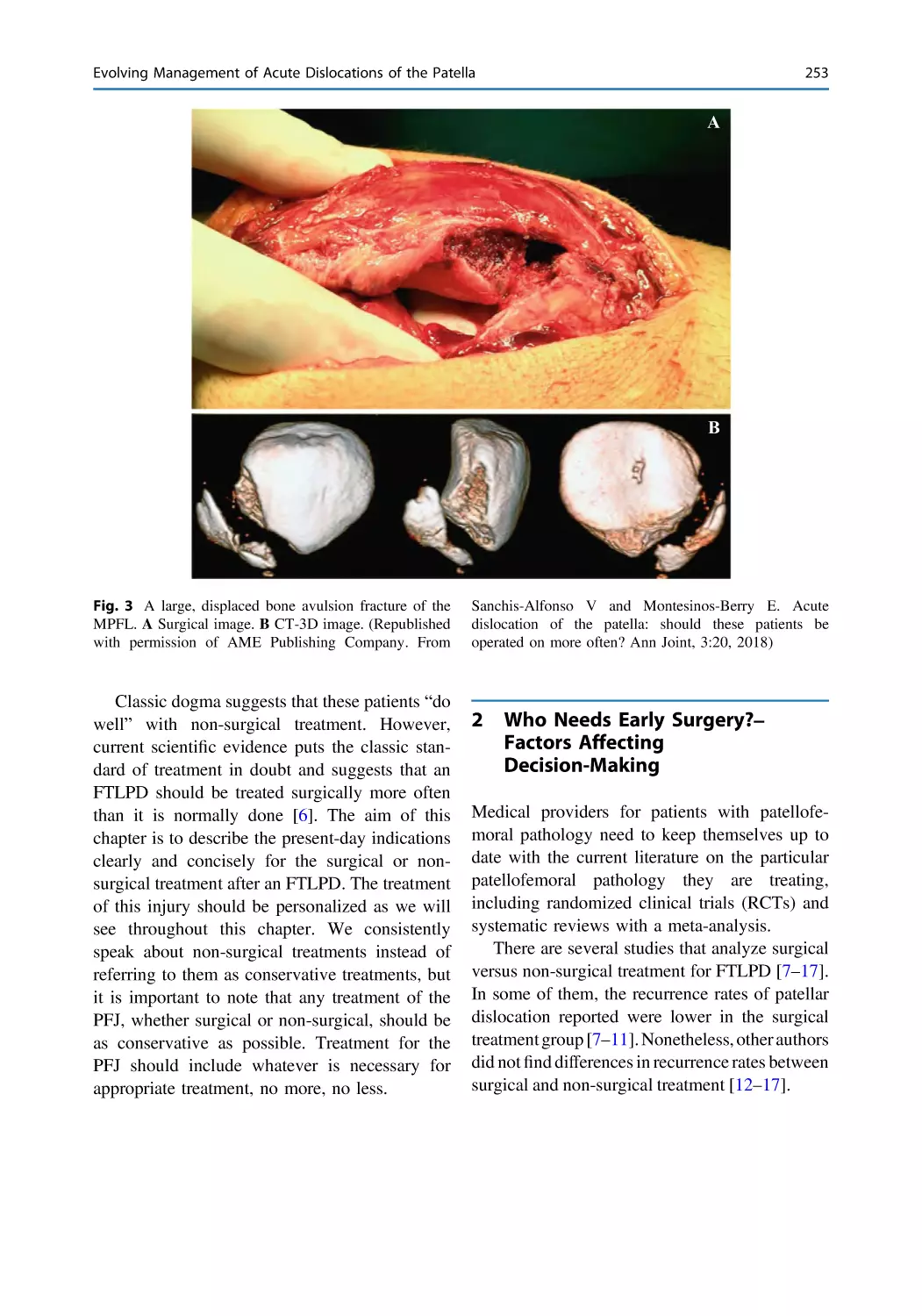 2 Who Needs Early Surgery?–Factors Affecting Decision-Making