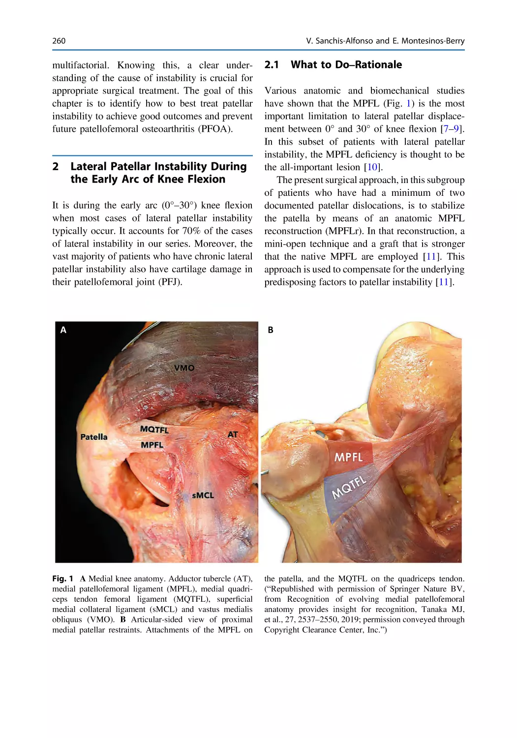 2 Lateral Patellar Instability During the Early Arc of Knee Flexion
2.1 What to Do–Rationale