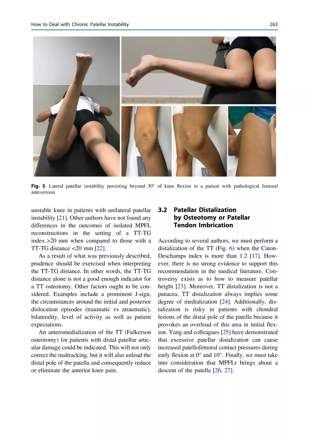 3.2 Patellar Distalization by Osteotomy or Patellar Tendon Imbrication