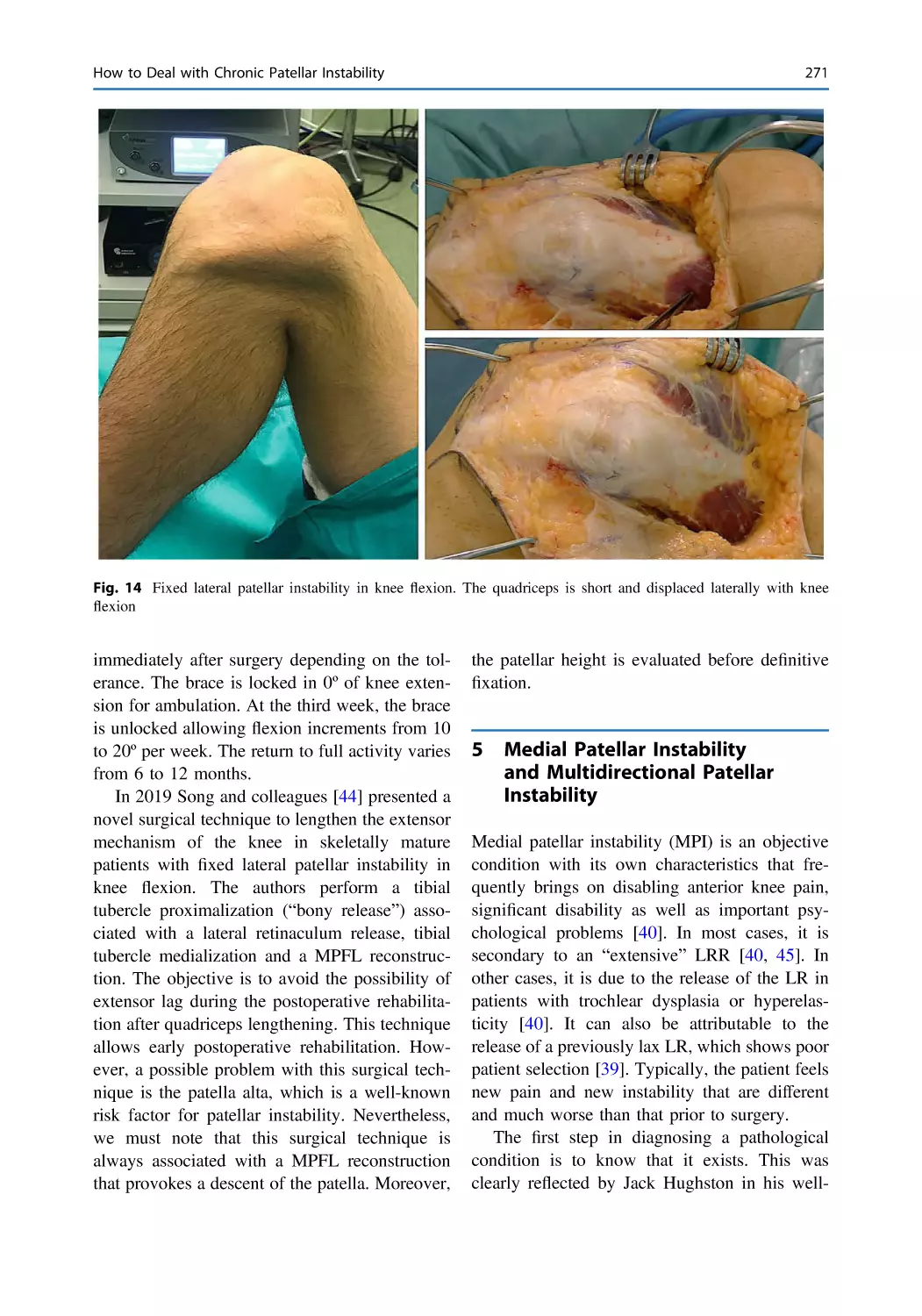 5 Medial Patellar Instability and Multidirectional Patellar Instability