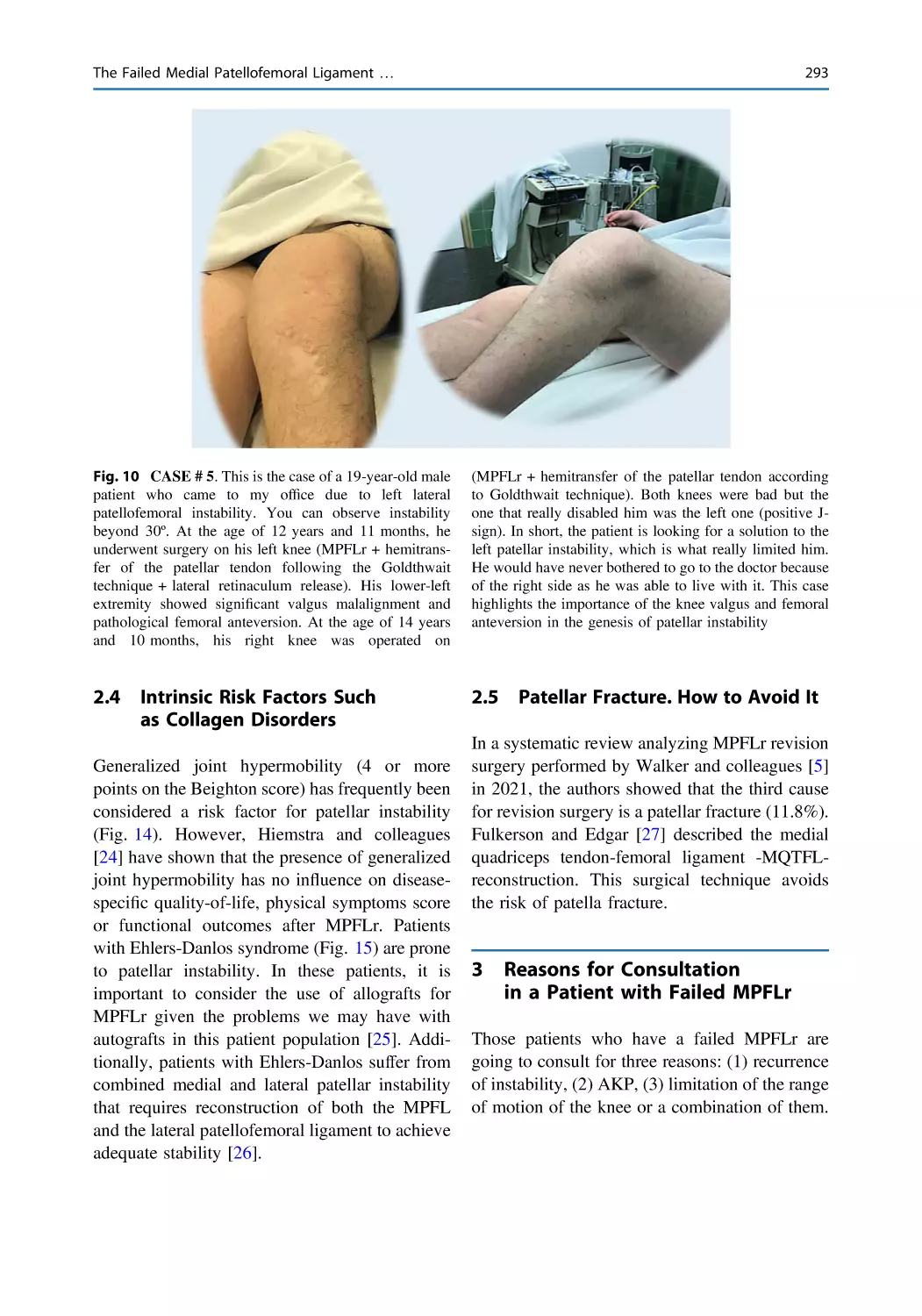 2.4 Intrinsic Risk Factors Such as Collagen Disorders
2.5 Patellar Fracture. How to Avoid It
3 Reasons for Consultation in a Patient with Failed MPFLr