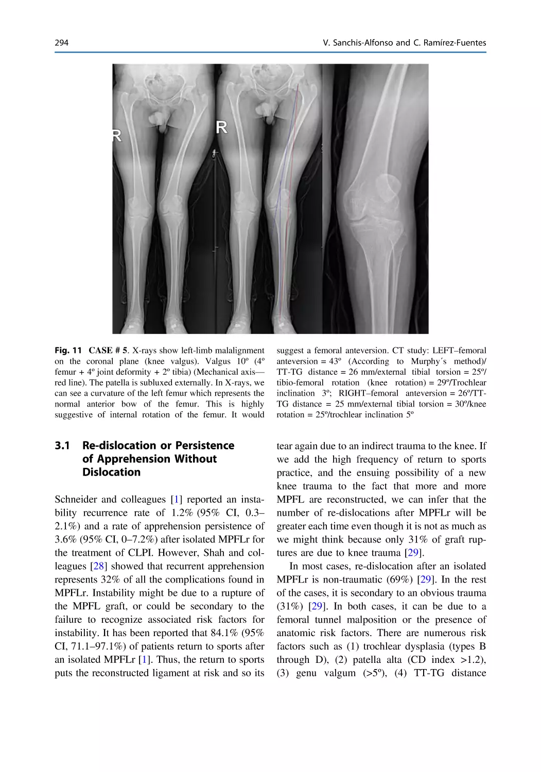 3.1 Re-dislocation or Persistence of Apprehension Without Dislocation