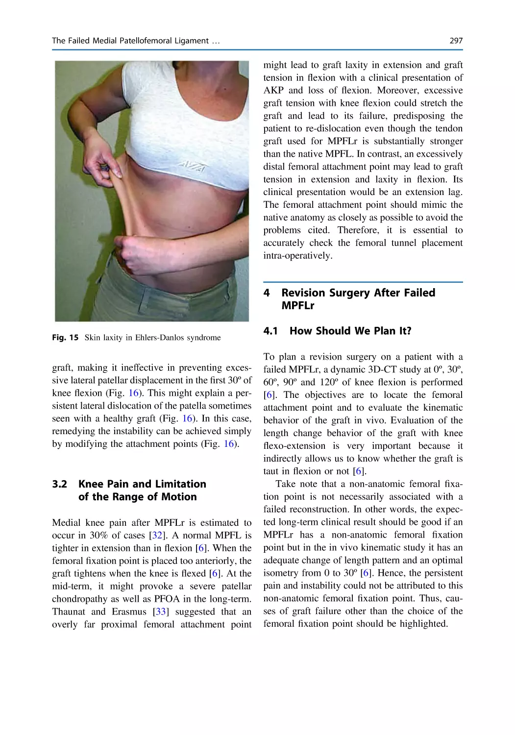 3.2 Knee Pain and Limitation of the Range of Motion
4 Revision Surgery After Failed MPFLr
4.1 How Should We Plan It?