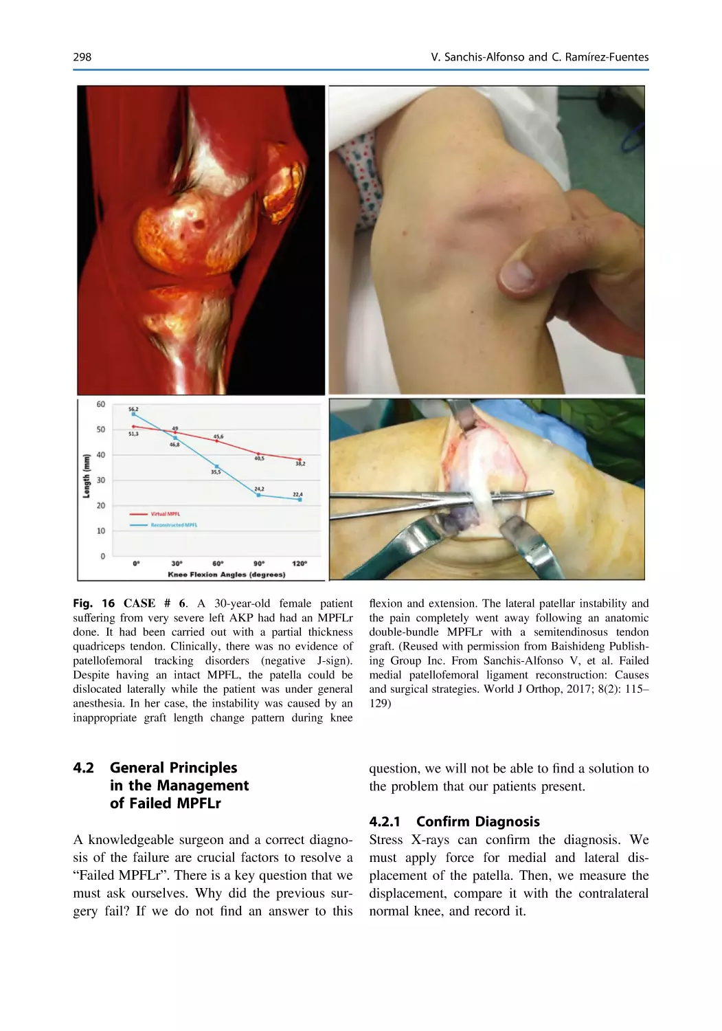 4.2 General Principles in the Management of Failed MPFLr
4.2.1 Confirm Diagnosis