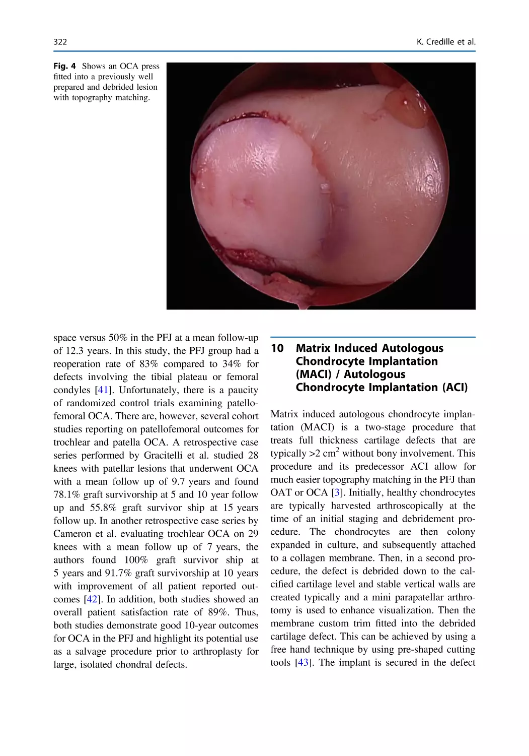 10 Matrix Induced Autologous Chondrocyte Implantation (MACI) / Autologous Chondrocyte Implantation (ACI)