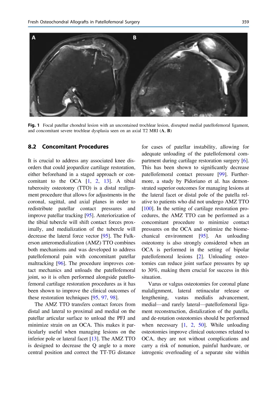 8.2 Concomitant Procedures