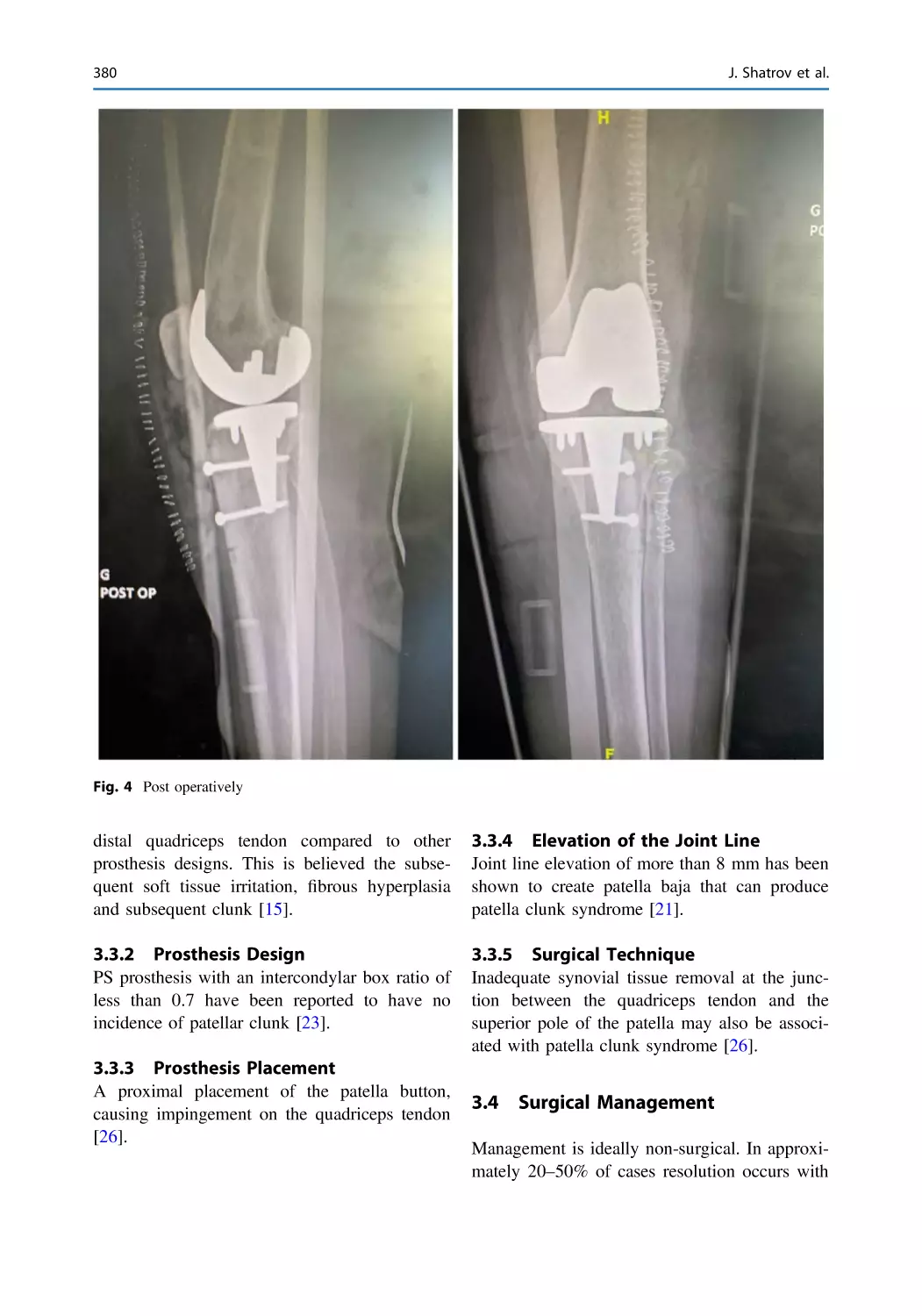 3.3.2 Prosthesis Design
3.3.3 Prosthesis Placement
3.3.4 Elevation of the Joint Line
3.3.5 Surgical Technique
3.4 Surgical Management